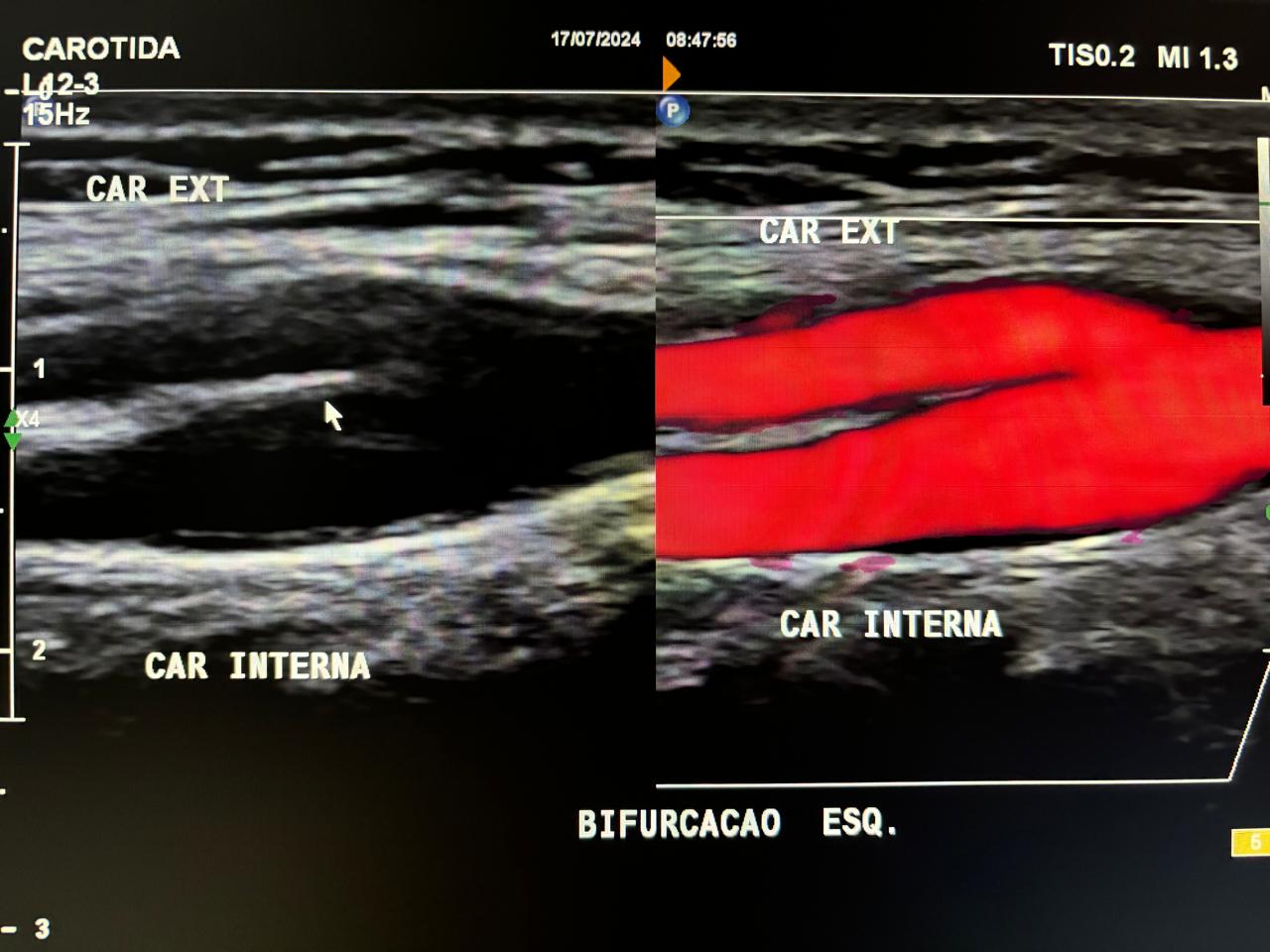 exame ecodoppler vascular em curitiba